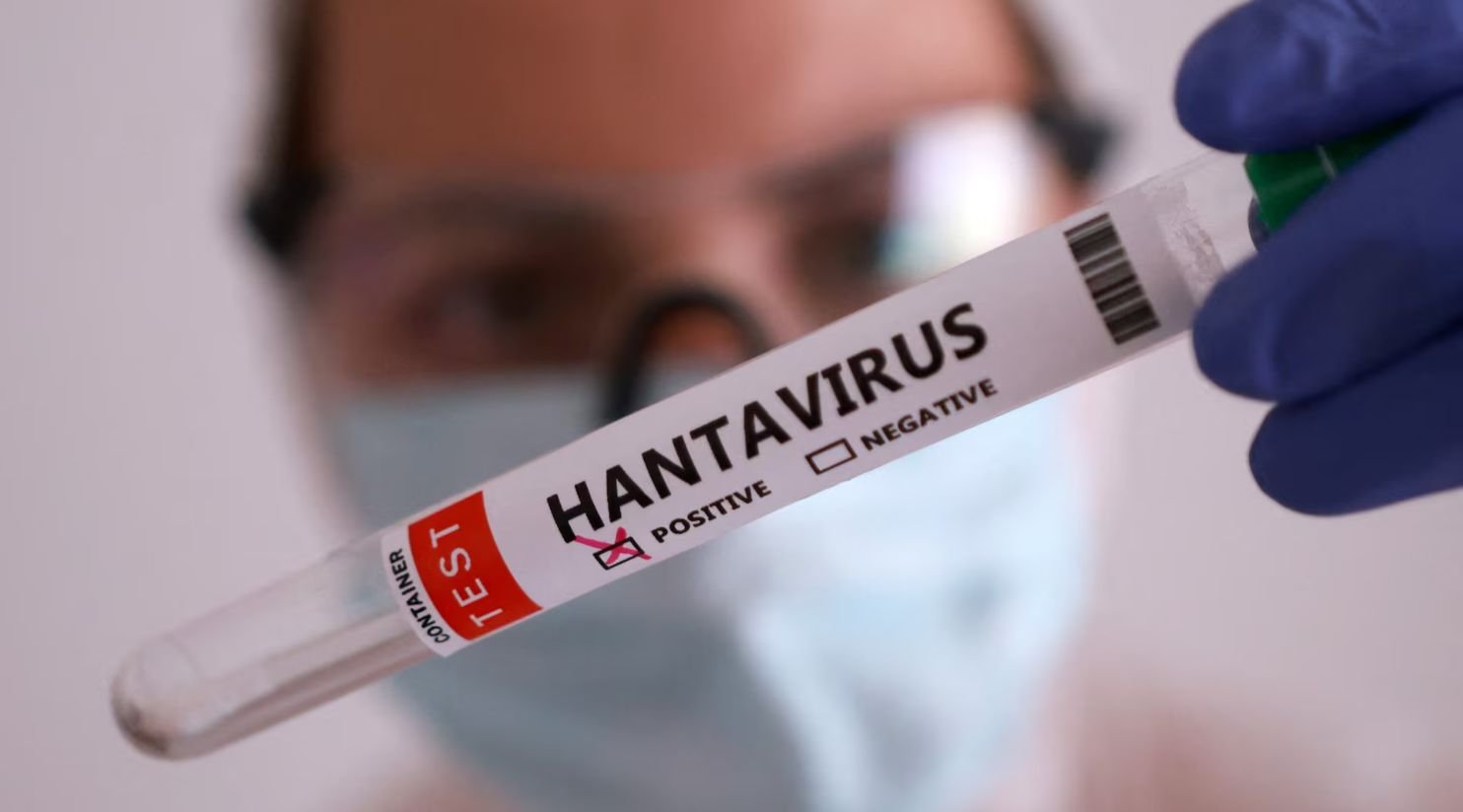 What Is Hantavirus? Should you be worried?